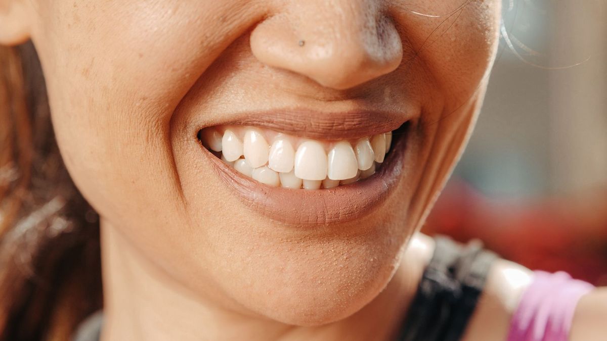 Avaliação de sorriso gengival em clínica odontológica de São Bernardo do Campo